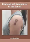 Diagnosis and Management of Skin Cancer cover