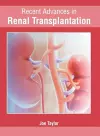 Recent Advances in Renal Transplantation cover