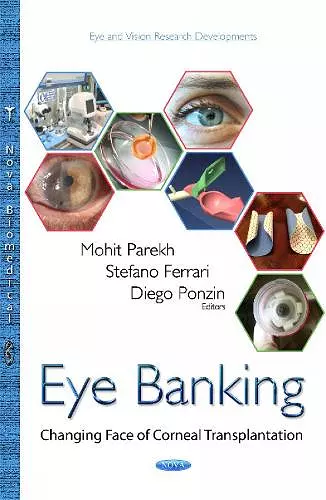 Eye Banking cover