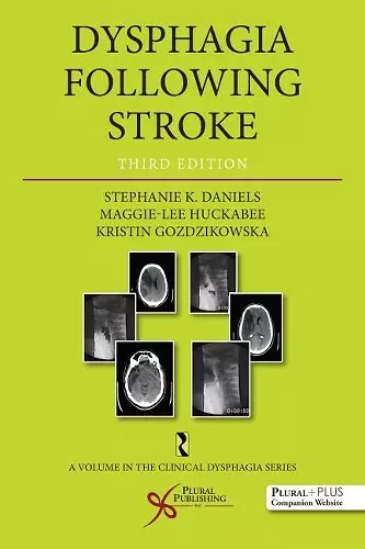 Dysphagia Following Stroke cover