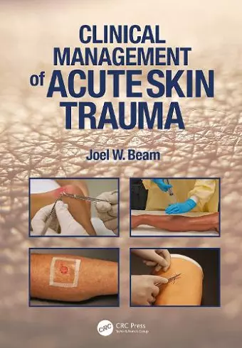 Clinical Management of Acute Skin Trauma cover