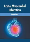 Acute Myocardial Infarction cover