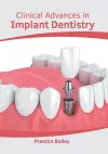 Clinical Advances in Implant Dentistry cover