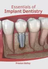 Essentials of Implant Dentistry cover
