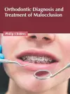 Orthodontic Diagnosis and Treatment of Malocclusion cover