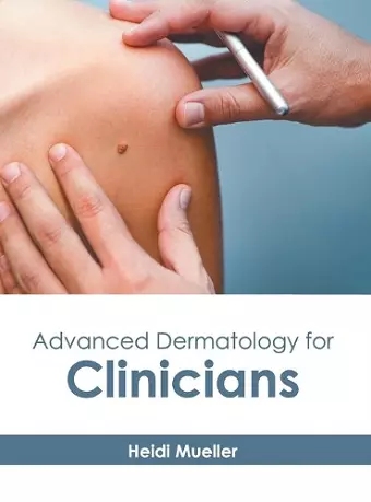 Advanced Dermatology for Clinicians cover