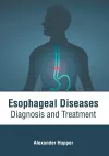 Esophageal Diseases: Diagnosis and Treatment cover