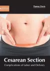 Cesarean Section: Complications of Labor and Delivery cover