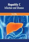 Hepatitis C: Infection and Disease cover