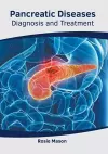 Pancreatic Diseases: Diagnosis and Treatment cover