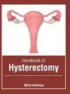 Handbook of Hysterectomy cover