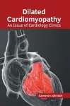 Dilated Cardiomyopathy: An Issue of Cardiology Clinics cover