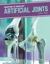 Artificial Joints cover