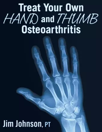 Treat Your Own Hand and Thumb Osteoarthritis cover