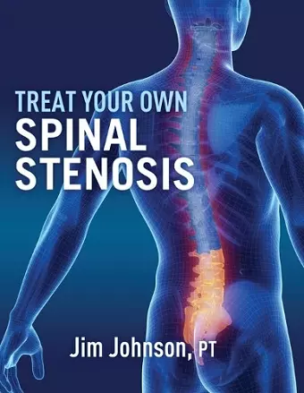 Treat Your Own Spinal Stenosis cover