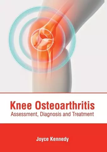 Knee Osteoarthritis: Assessment, Diagnosis and Treatment cover