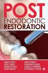 Post Endodontic Restoration cover