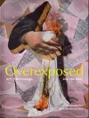 Overexposed cover