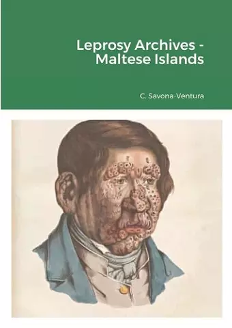 Leprosy Archives - Maltese Islands cover