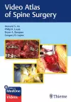 Video Atlas of Spine Surgery cover