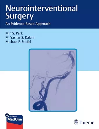 Neurointerventional Surgery cover