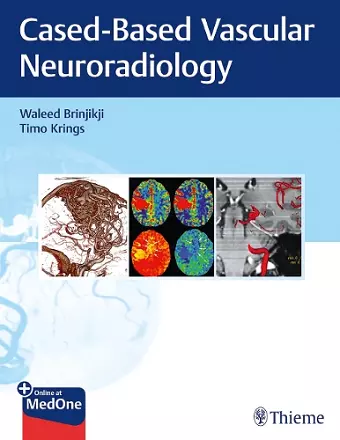 Imaging in Neurovascular Disease cover