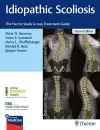 Idiopathic Scoliosis cover