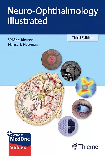 Neuro-Ophthalmology Illustrated cover