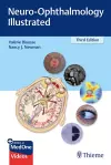 Neuro-Ophthalmology Illustrated cover