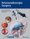 Neuroendoscopic Surgery cover