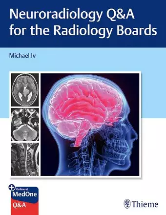 Neuroradiology Q&A for the Radiology Boards cover