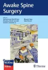 Awake Spine Surgery cover