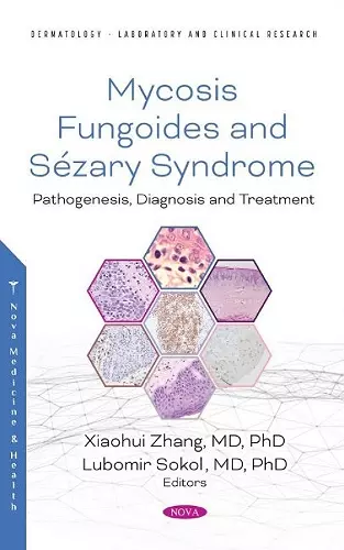 Mycosis Fungoides and Sezary Syndrome cover