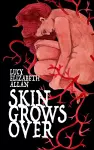 Skin Grows Over cover