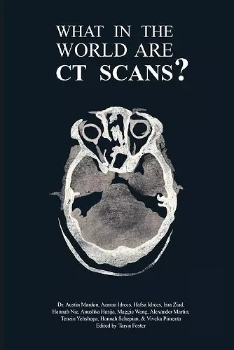 What in the World are CT Scans? cover