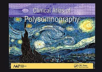 Clinical Atlas of Polysomnography cover