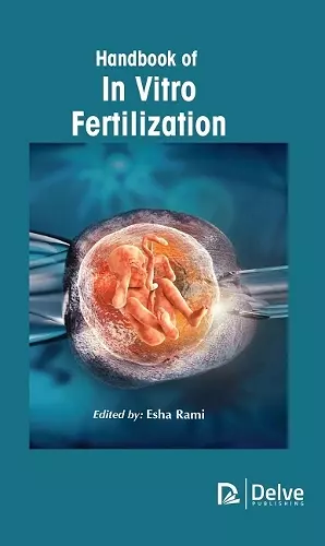 Handbook of in Vitro Fertilization cover
