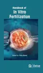 Handbook of in Vitro Fertilization cover