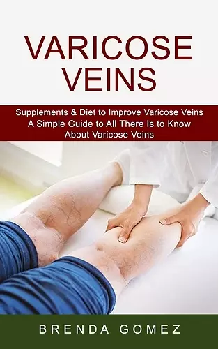 Varicose Veins cover