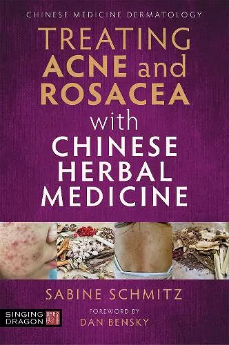 Treating Acne and Rosacea with Chinese Herbal Medicine cover