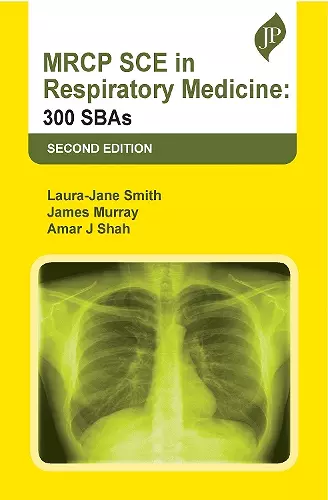 MRCP SCE in Respiratory Medicine cover