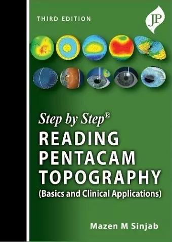 Step by Step: Reading Pentacam Topography cover