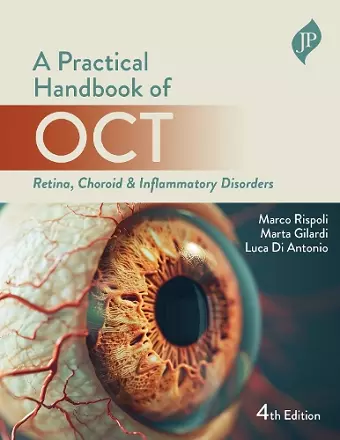 Practical Handbook of OCT cover
