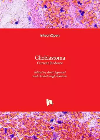 Glioblastoma cover