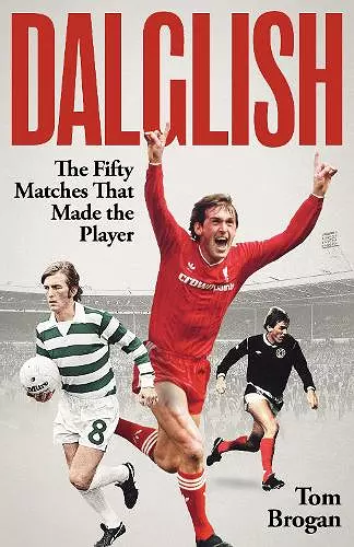 Dalglish cover