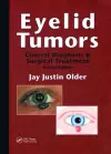 Eyelid Tumors cover