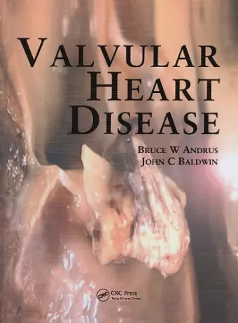 Valvular Heart Disease cover