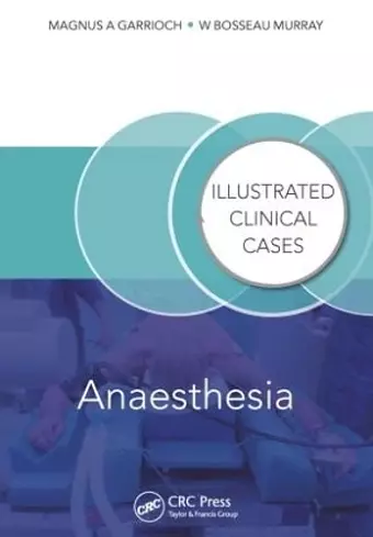 Anaesthesia cover