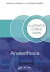 Anaesthesia cover