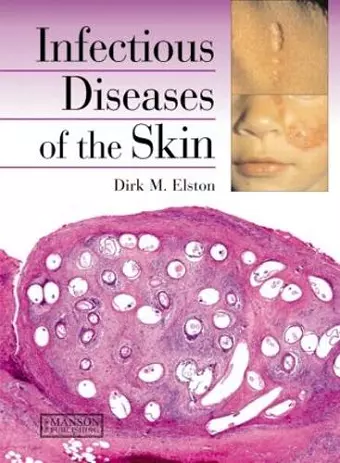 Infectious Diseases of the Skin cover